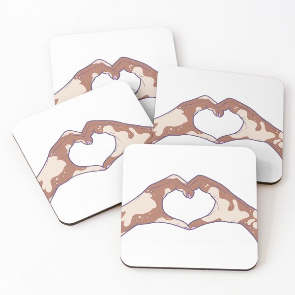 Item preview, Vitiligo Love designed and sold by illhustration.