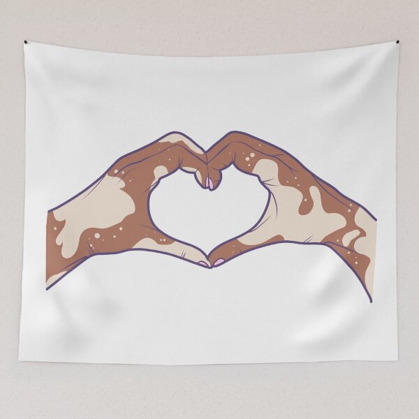 Item preview, Vitiligo Love designed and sold by illhustration.