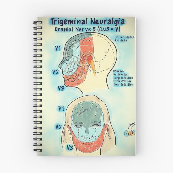 Item preview, Neuralgia trigeminal designed and sold by AdaptablePolar.