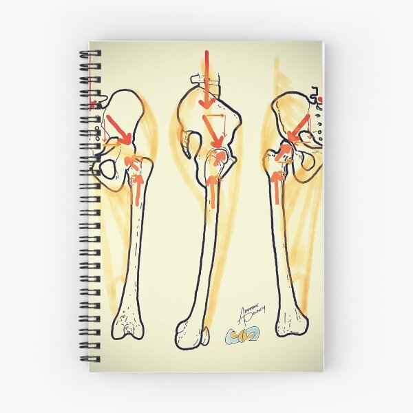 Item preview, Pelvis designed and sold by AdaptablePolar.