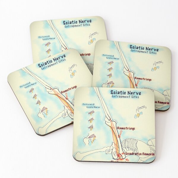 Item preview, Sciatic Nerve designed and sold by AdaptablePolar.