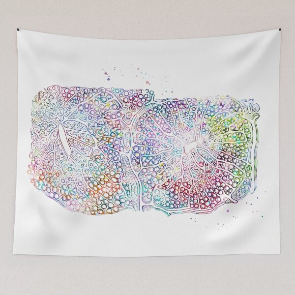 Item preview, Fatty infiltration of the Human Liver designed and sold by EvasDreams.