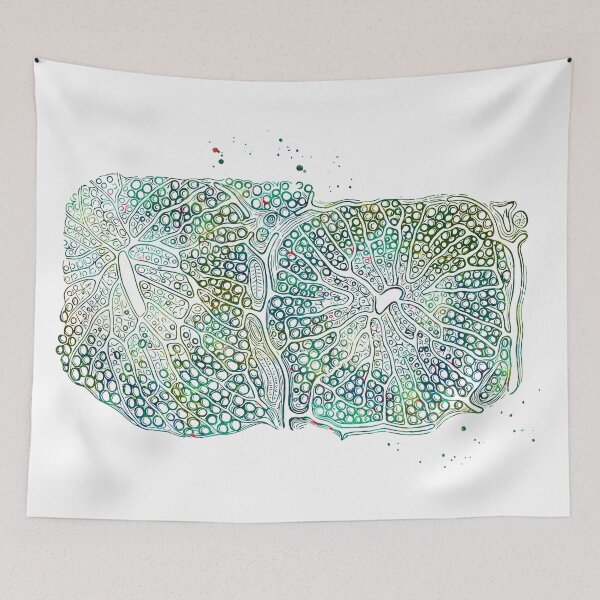 Item preview, Fatty infiltration of the Human Liver designed and sold by EvasDreams.