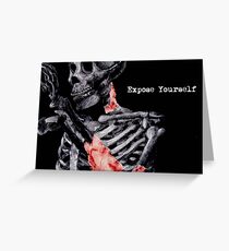 Expose Yourself Greeting Card