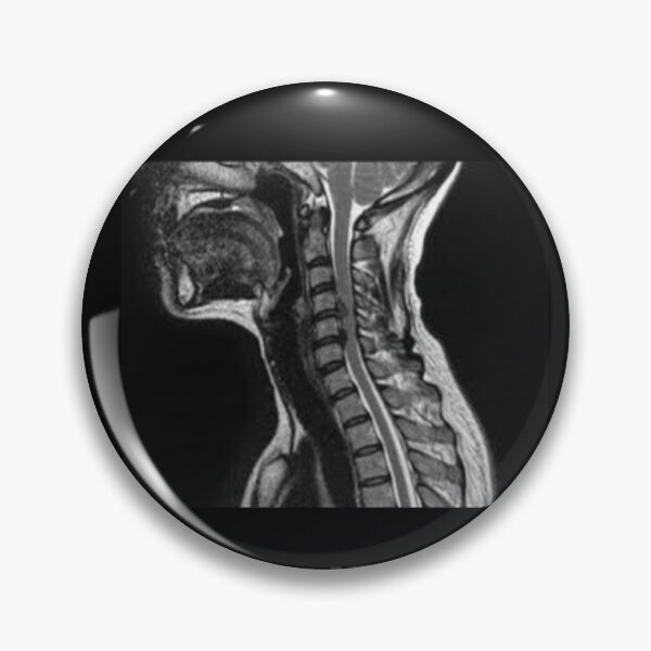 Item preview, MRI scan designed and sold by moth-creature.