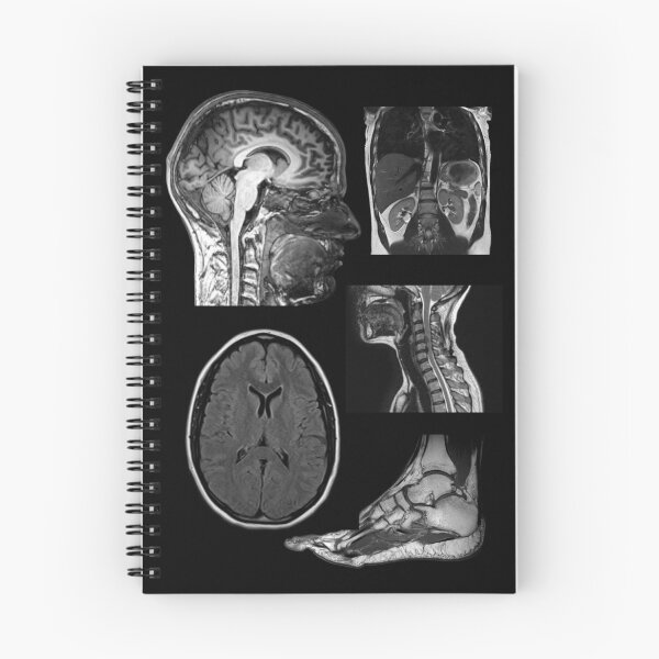 Item preview, MRI scan designed and sold by moth-creature.