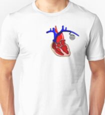 martin pacemaker shirts