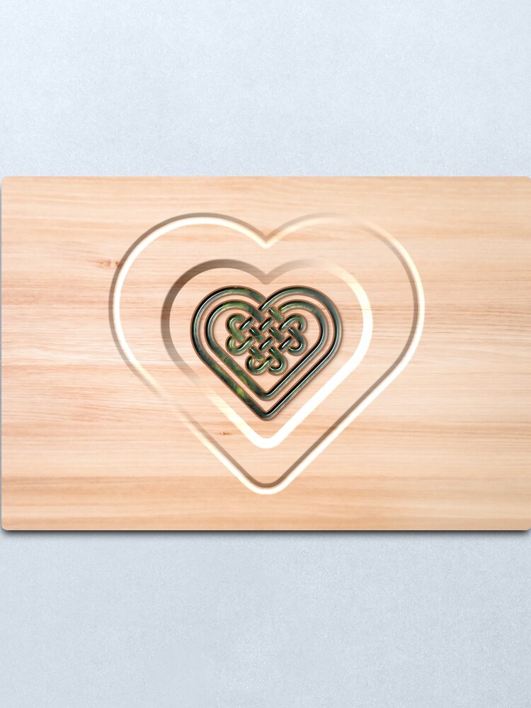 Alternate view of Unity: Hearts Metal Print