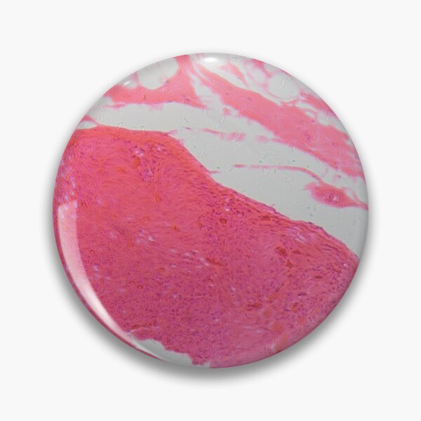 Item preview, A cross section of human nerve cells under the microscope. designed and sold by Zosimus.