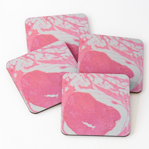 Item preview, A cross section of human nerve cells under the microscope. designed and sold by Zosimus.