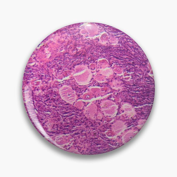 Item preview, A longitudinal section of human spinal ganglion cells under the microscope. designed and sold by Zosimus.