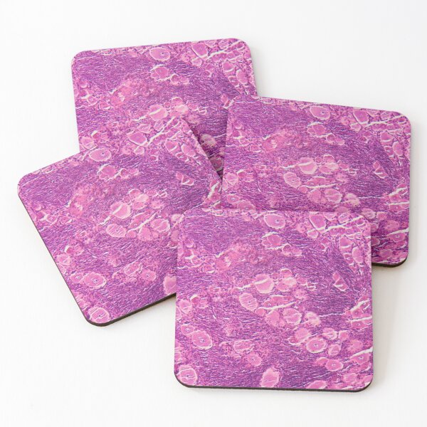 Item preview, A longitudinal section of human spinal ganglion cells under the microscope. designed and sold by Zosimus.