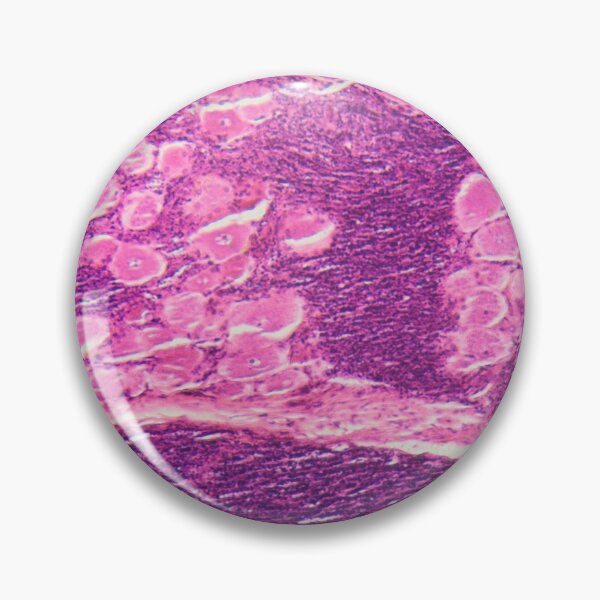 Item preview, Longitudinal section of human spinal ganglion cells under the microscope designed and sold by Zosimus.