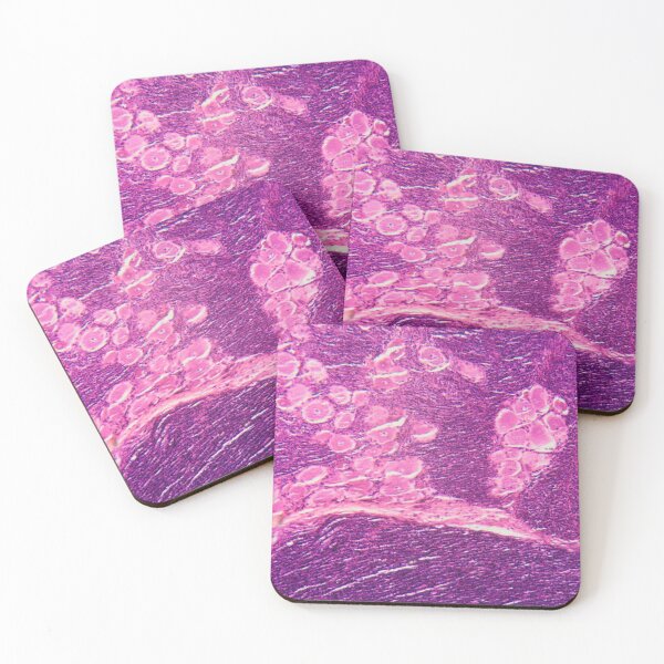 Item preview, Longitudinal section of human spinal ganglion cells under the microscope designed and sold by Zosimus.