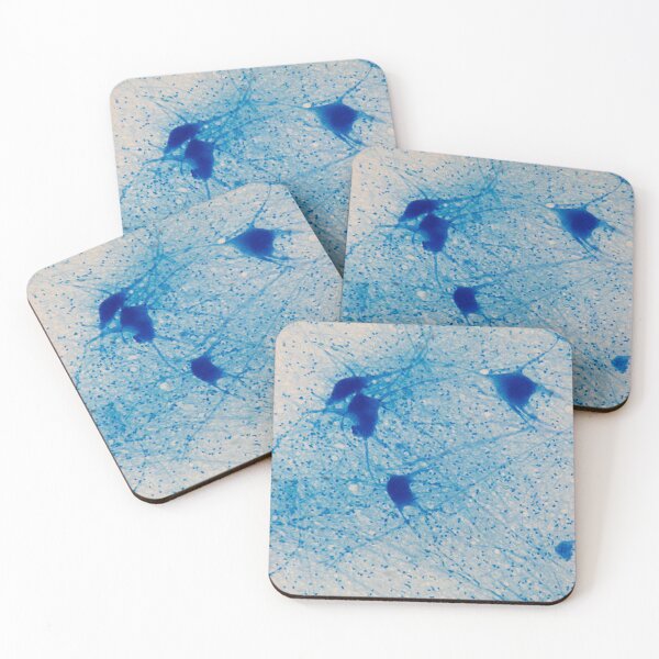 Item preview, Motor Neuron cells under the microscope designed and sold by Zosimus.