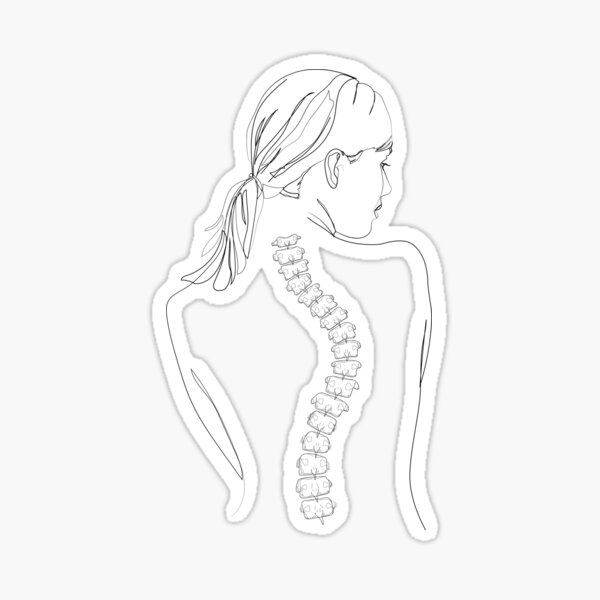 Item preview, Womans Scoliosis Spine designed and sold by FusionStudio.