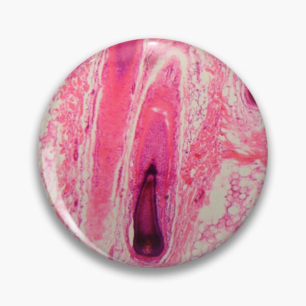 Item preview, Section of a human hair follicle in skin under the microscope designed and sold by Zosimus.