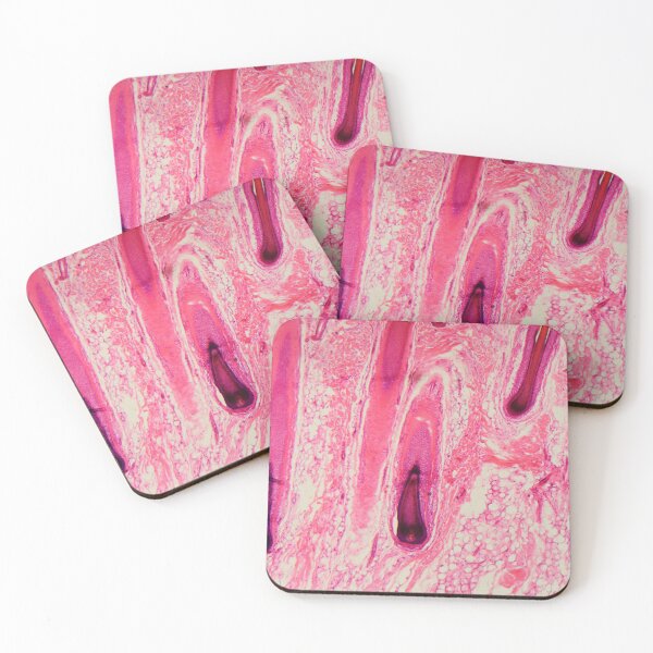 Item preview, Section of a human hair follicle in skin under the microscope designed and sold by Zosimus.