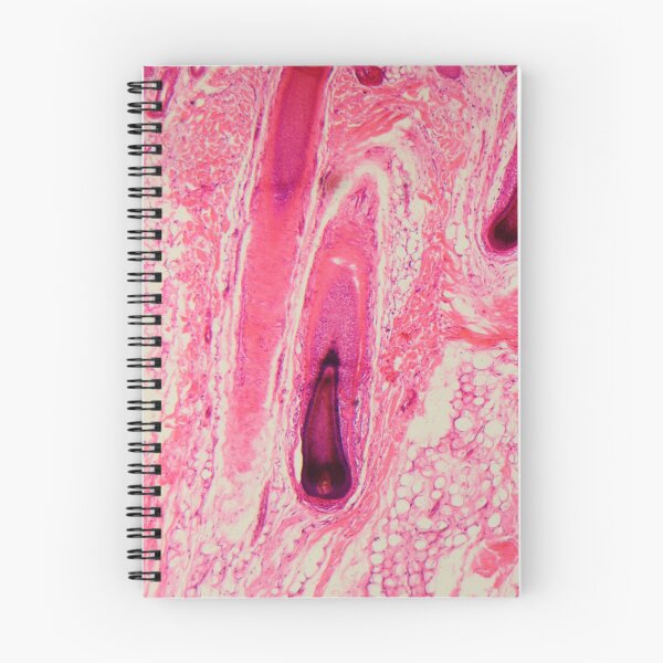 Item preview, Section of a human hair follicle in skin under the microscope designed and sold by Zosimus.