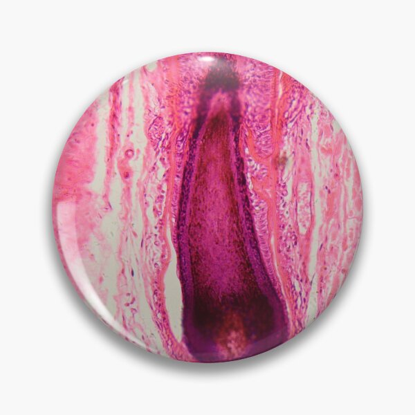 Item preview, Human hair follicle in skin under the microscope designed and sold by Zosimus.