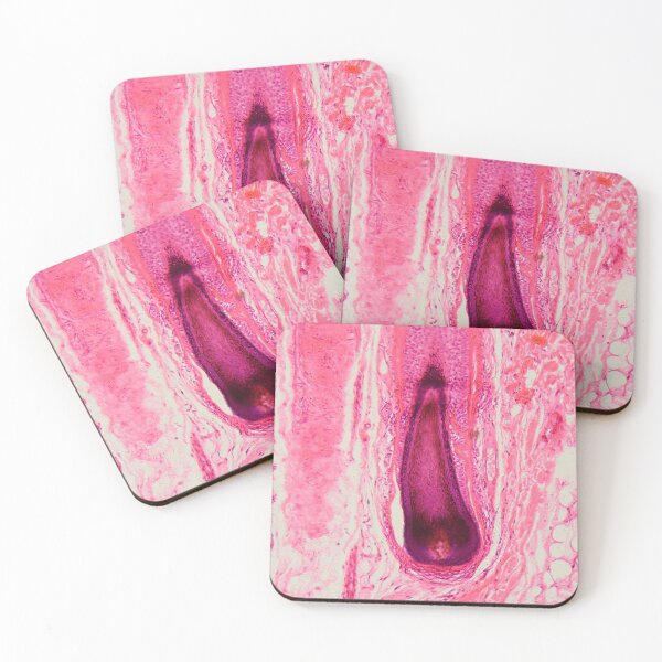 Item preview, Human hair follicle in skin under the microscope designed and sold by Zosimus.