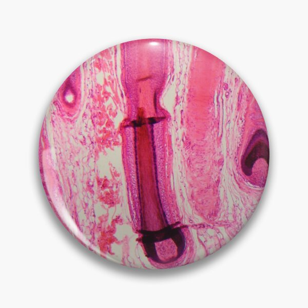 Item preview, Human hair follicle in skin under the microscope designed and sold by Zosimus.