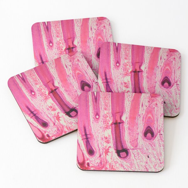 Item preview, Human hair follicle in skin under the microscope designed and sold by Zosimus.
