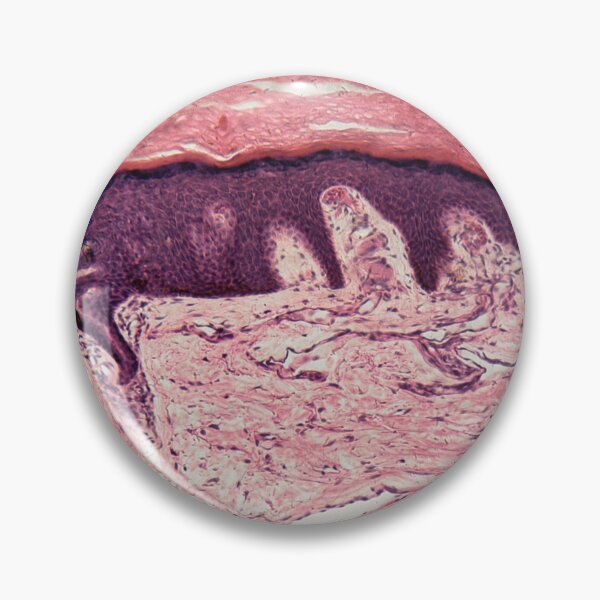 Item preview, Human skin with sweat glands designed and sold by Zosimus.
