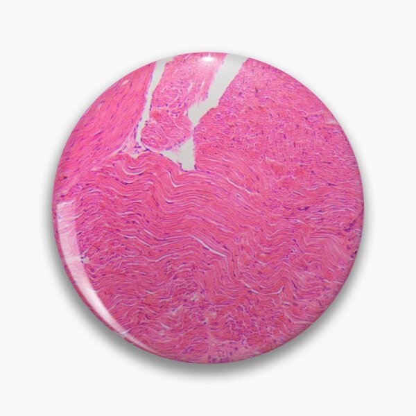 Item preview, Atrial wall of a human heart in the microscope designed and sold by Zosimus.