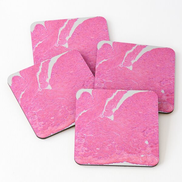 Item preview, Atrial wall of a human heart in the microscope designed and sold by Zosimus.