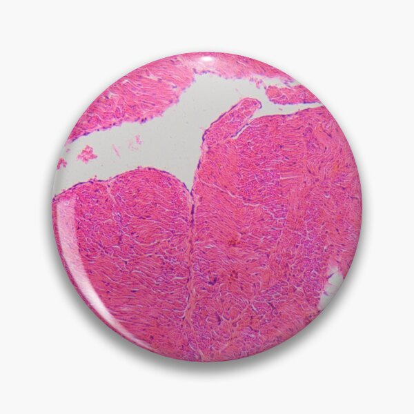 Item preview, Section of an atrial wall of a human heart in the microscope designed and sold by Zosimus.