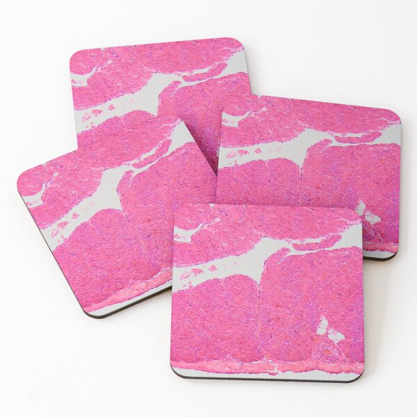 Item preview, Section of an atrial wall of a human heart in the microscope designed and sold by Zosimus.