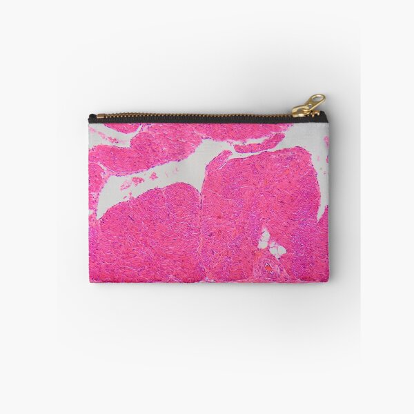 Item preview, Section of an atrial wall of a human heart in the microscope designed and sold by Zosimus.