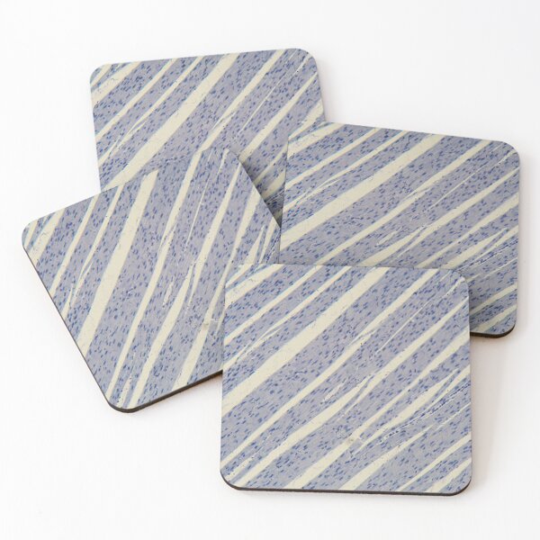 Item preview, Human cardiac muscle under the microscope designed and sold by Zosimus.