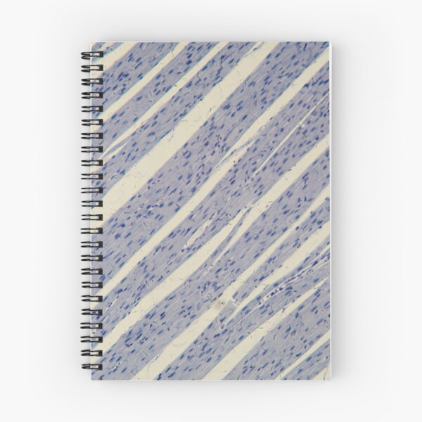 Item preview, Human cardiac muscle under the microscope designed and sold by Zosimus.
