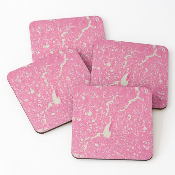 Item preview, Human brain under the microscope designed and sold by Zosimus.