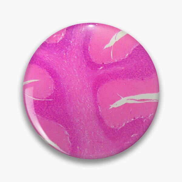 Item preview, Human cerebellum under the microscope designed and sold by Zosimus.