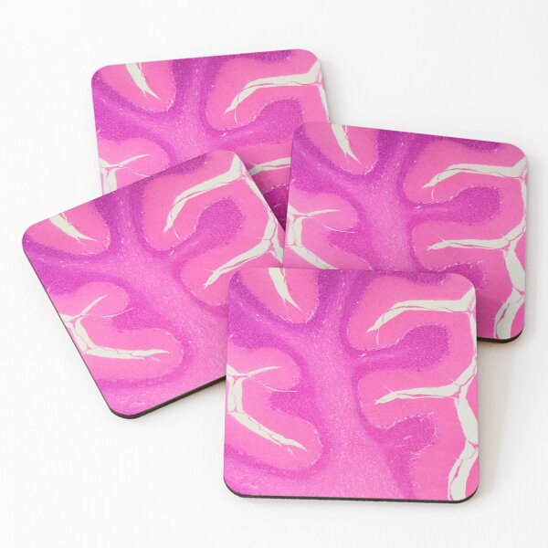 Item preview, Human cerebellum under the microscope designed and sold by Zosimus.