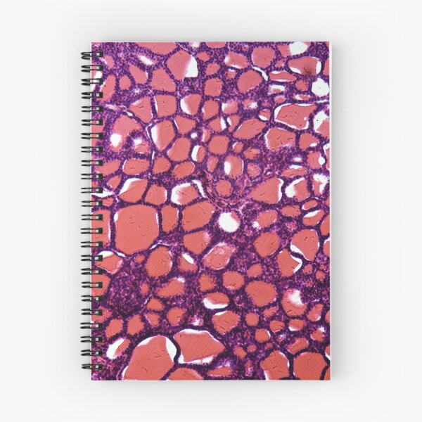 Item preview, Section of thyroid gland cells under the microscope designed and sold by Zosimus.