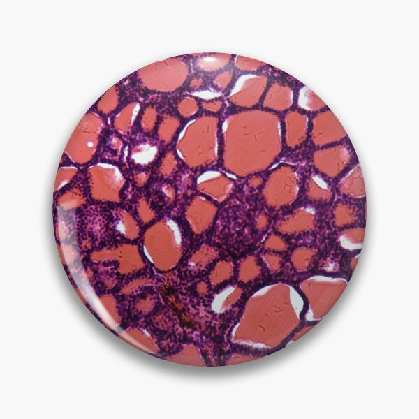Item preview, Thyroid gland cells under the microscope designed and sold by Zosimus.