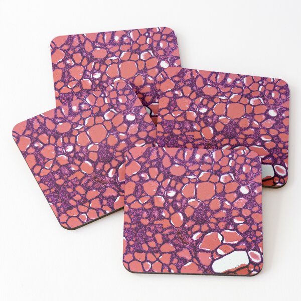 Item preview, Thyroid gland cells under the microscope designed and sold by Zosimus.