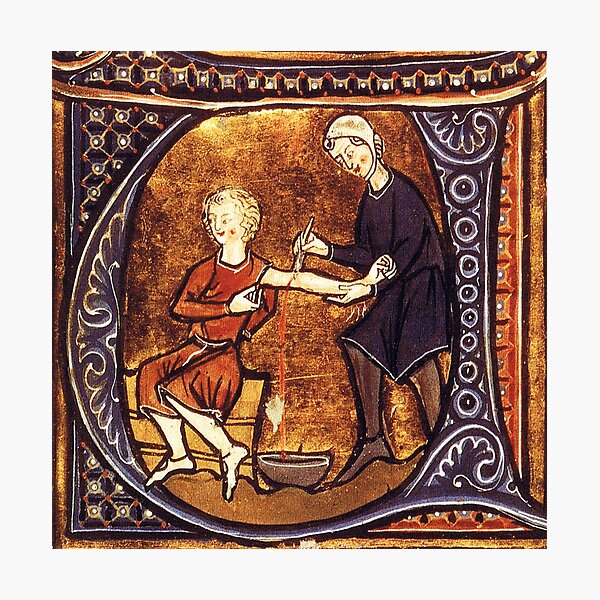 Item preview, Medieval Bloodletting, Ancient Medicine designed and sold by ScienceSource.