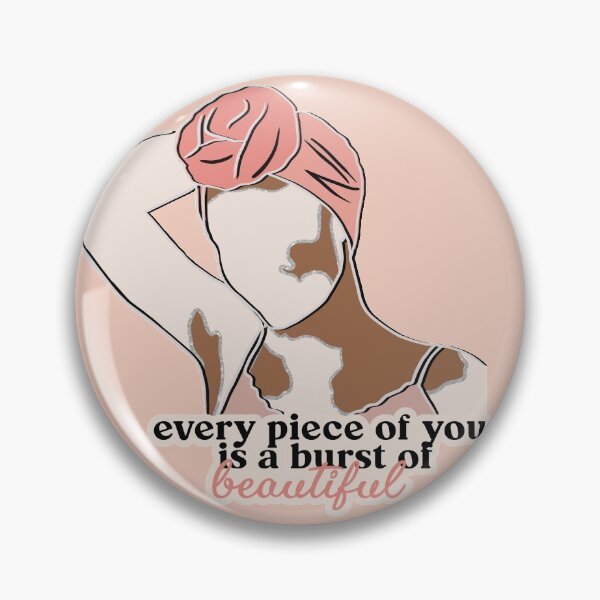 Item preview, Vitiligo Skin Condition designed and sold by sweet dreamer.