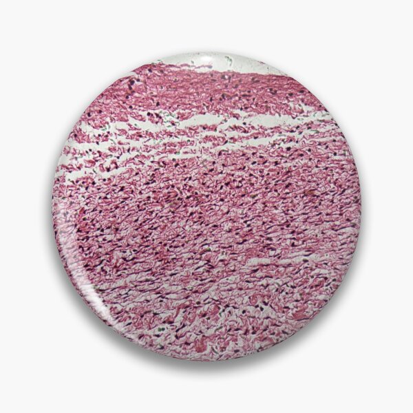 Item preview, Bone of a human fetal head under the microscope designed and sold by Zosimus.