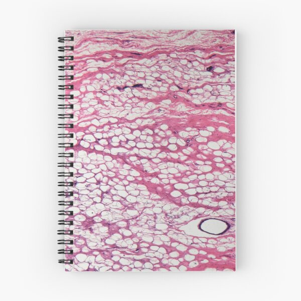 Item preview, Section of human mammary gland cells under the microscope designed and sold by Zosimus.