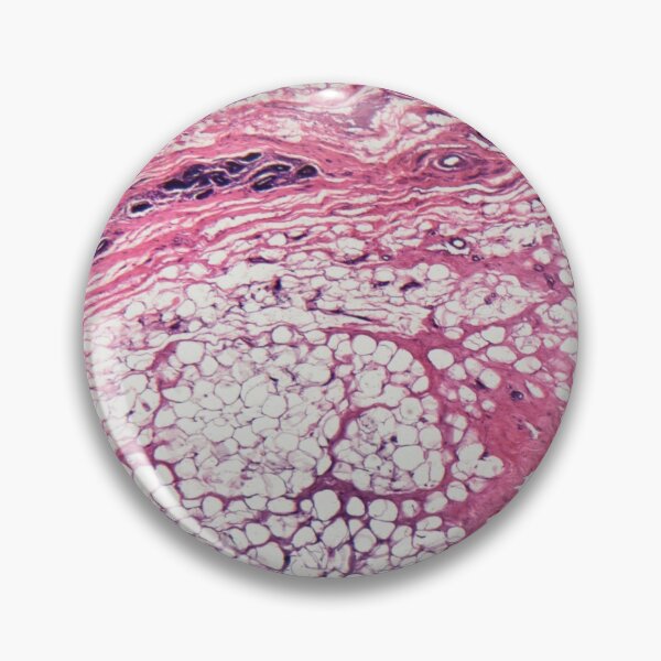 Item preview, Human mammary gland cells under the microscope designed and sold by Zosimus.