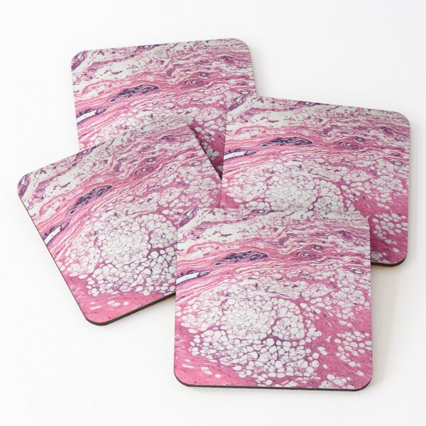 Item preview, Human mammary gland cells under the microscope designed and sold by Zosimus.