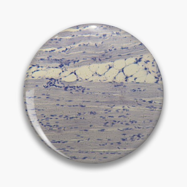 Item preview, Human skeletal muscle under the microscope designed and sold by Zosimus.