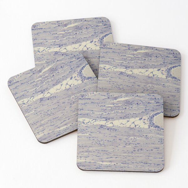 Item preview, Human skeletal muscle under the microscope designed and sold by Zosimus.