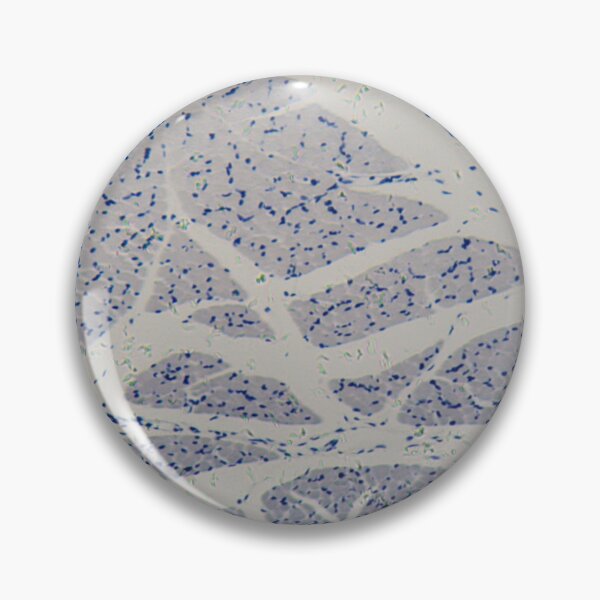 Item preview, Human skeletal muscle cells under the microscope designed and sold by Zosimus.